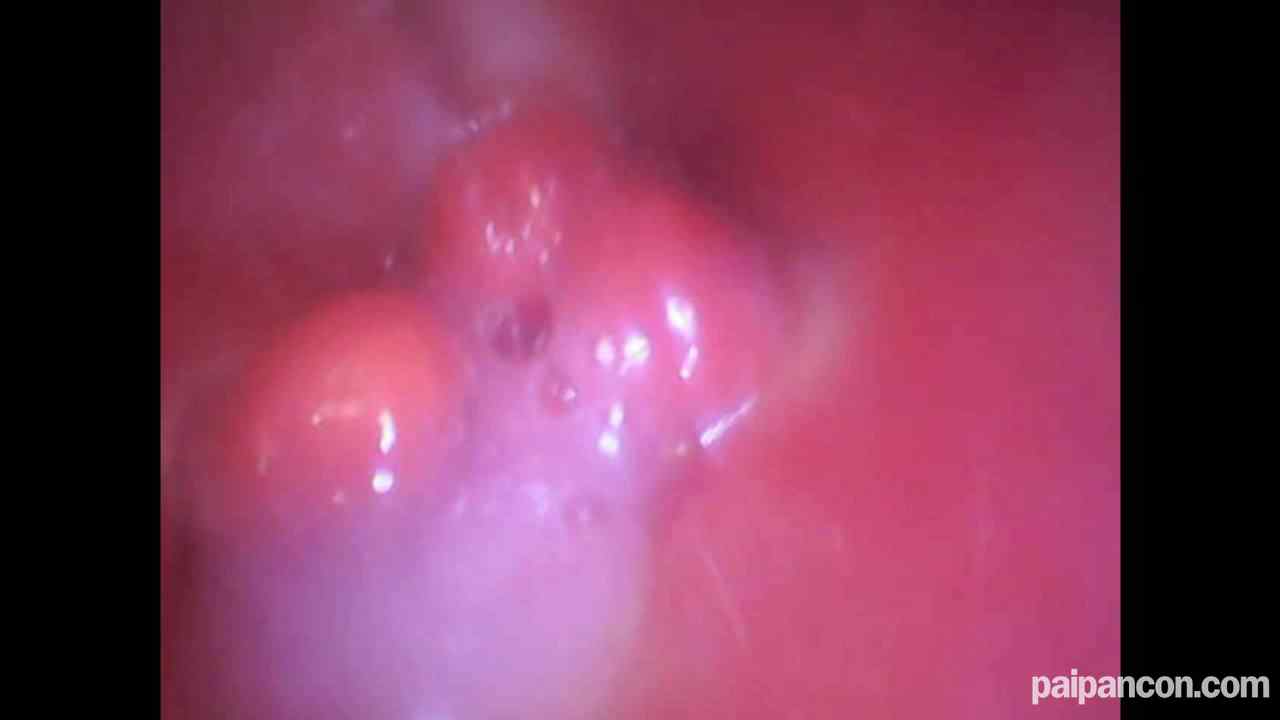 FC2-PPV-4798858 - ♀186 素朴で笑顔あふれるあすかちゃんはもちろん陰毛あり パンティチェックに赤面 カメラの前で丸裸で恥ずかしがるが、生ちんぽに喘いで最後は半外半中出し　★特典で無修正と膣内カメラ thumbnail_8.jpg